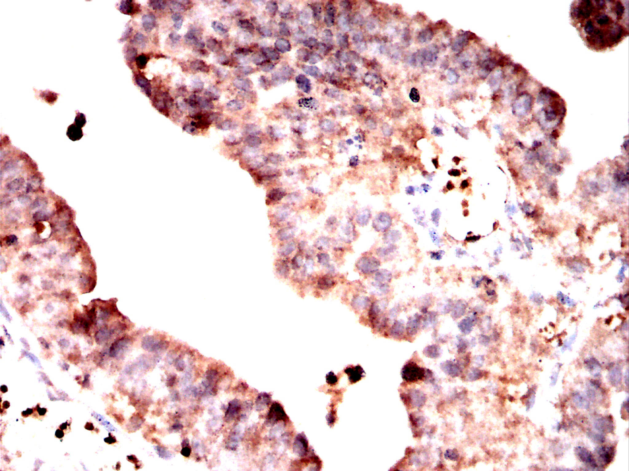 IHC